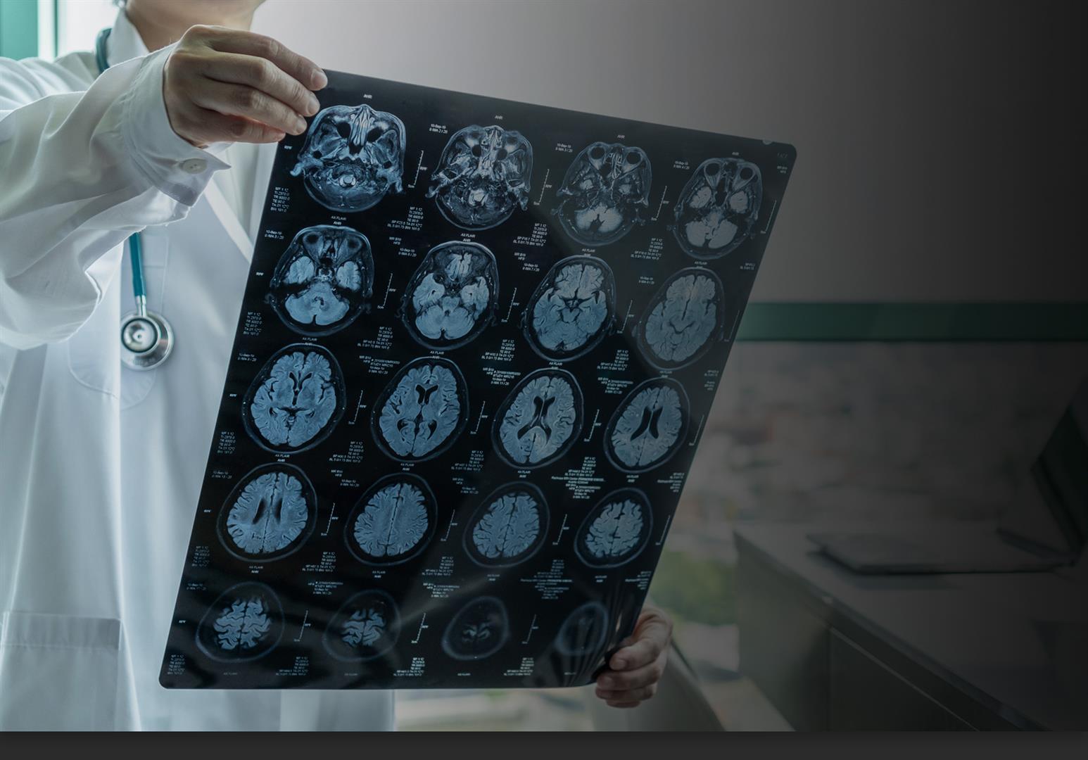 Traumatic Brain Injuries