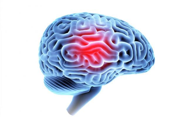 Brain Injuries